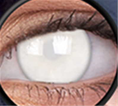 LENTILLES ANNUELLES BLIND WHITE (aveugles) , lentilles blanches couvrant la pupille