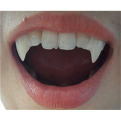 Dents De Vampire Dents De Vampire Paris Dents De Vampire Fausses Dents Dents De Vampire Paris